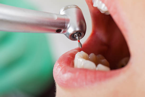 Best Emergency Cosmetic Dentistry in Scotts Valley, CA
